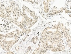 Invitrogen SF3B1 Polyclonal Antibody 100 &mu;L; Unconjugated:Antibodies,