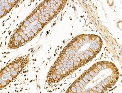 Invitrogen SF3B1 Polyclonal Antibody 100 &mu;L; Unconjugated:Antibodies,