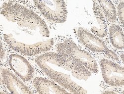 Invitrogen SF3B1 Polyclonal Antibody 100 &mu;L; Unconjugated:Antibodies,