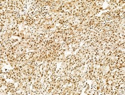Invitrogen SF3B1 Polyclonal Antibody 100 &mu;L; Unconjugated:Antibodies,
