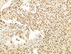 Invitrogen SF3B1 Polyclonal Antibody 100 &mu;L; Unconjugated:Antibodies,