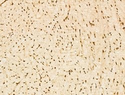 Invitrogen SF3B1 Polyclonal Antibody 100 &mu;L; Unconjugated:Antibodies,