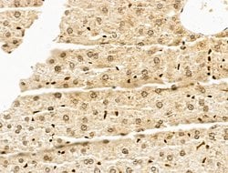 Invitrogen SF3B1 Polyclonal Antibody 100 &mu;L; Unconjugated:Antibodies,