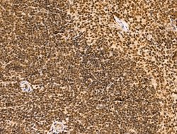 Invitrogen SF3B1 Polyclonal Antibody 100 &mu;L; Unconjugated:Antibodies,