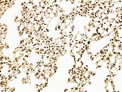 Invitrogen SF3B1 Polyclonal Antibody 100 &mu;L; Unconjugated:Antibodies,