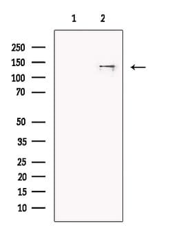Invitrogen SF3B1 Polyclonal Antibody 100 &mu;L; Unconjugated:Antibodies,