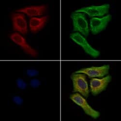 SCAP Polyclonal Antibody:Antibodies, Polyclonal