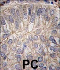 Invitrogen P-cadherin Polyclonal Antibody 400 &mu;L; Unconjugated:Antibodies,