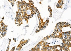 Invitrogen SCARF1 Polyclonal Antibody 100 &mu;L; Unconjugated:Antibodies,