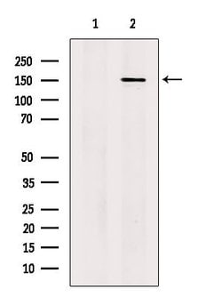 Invitrogen PDS5A Polyclonal Antibody 100 &mu;L | Buy Online | Invitrogen&trade; | Fisher Scientific