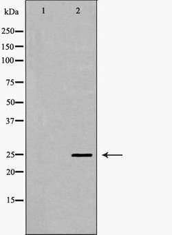 Invitrogen SCN4B Polyclonal Antibody 100 &mu;L; Unconjugated:Antibodies,