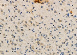 Invitrogen CD62L Polyclonal Antibody 100 μL; Unconjugated:Antibodies,