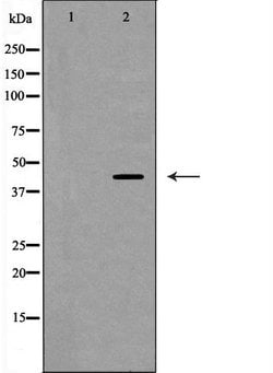 Invitrogen CD62L Polyclonal Antibody 100 μL; Unconjugated:Antibodies,