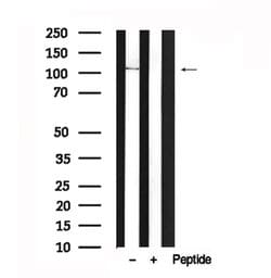 Invitrogen SEMA4B Polyclonal Antibody 100 &mu;L; Unconjugated:Antibodies,