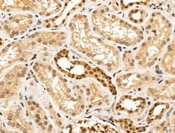Invitrogen ARTS Polyclonal Antibody 100 &mu;L; Unconjugated:Antibodies,