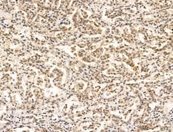 Invitrogen ARTS Polyclonal Antibody 100 &mu;L; Unconjugated:Antibodies,