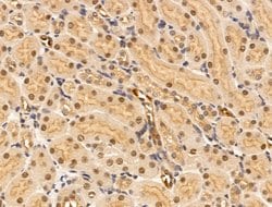 Invitrogen ARTS Polyclonal Antibody 100 &mu;L; Unconjugated:Antibodies,