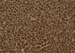 Invitrogen SESN2 Polyclonal Antibody 100 &mu;L | Buy Online | Invitrogen&trade; | Fisher Scientific