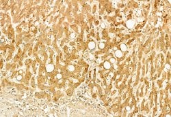 Invitrogen SESN2 Polyclonal Antibody 100 &mu;L | Buy Online | Invitrogen&trade; | Fisher Scientific
