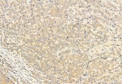 Invitrogen SESN2 Polyclonal Antibody 100 &mu;L | Buy Online | Invitrogen&trade; | Fisher Scientific