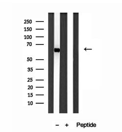 Invitrogen SESN2 Polyclonal Antibody 100 &mu;L | Buy Online | Invitrogen&trade; | Fisher Scientific