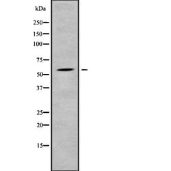 Invitrogen SFRS12 Polyclonal Antibody 100 &mu;L | Buy Online | Invitrogen&trade; | Fisher Scientific