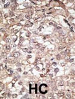 Invitrogen TLR1 Polyclonal Antibody 400 &mu;L; Unconjugated:Antibodies,