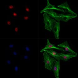 Invitrogen SGTA Polyclonal Antibody 100 &mu;L; Unconjugated:Antibodies,