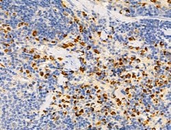Invitrogen SHANK3 Polyclonal Antibody 100 μL; Unconjugated:Antibodies,