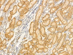 Invitrogen SHANK3 Polyclonal Antibody 100 μL; Unconjugated:Antibodies,