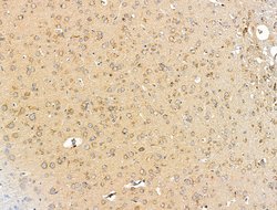 Invitrogen SHANK3 Polyclonal Antibody 100 μL; Unconjugated:Antibodies,