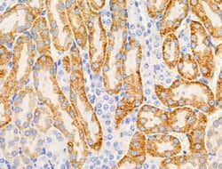 Invitrogen CD169 Polyclonal Antibody 100 &mu;L; Unconjugated:Anticorps,