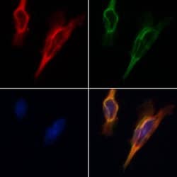 Invitrogen SIRT3 Polyclonal Antibody 100 μL; Unconjugated:Antibodies,