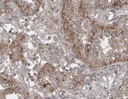 Invitrogen SIRT3 Polyclonal Antibody 100 μL; Unconjugated:Antibodies,