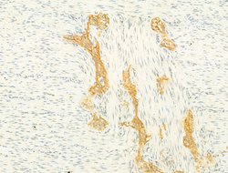 Invitrogen SIRT3 Polyclonal Antibody 100 μL; Unconjugated:Antibodies,