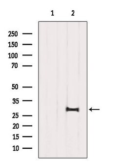 Invitrogen SIRT3 Polyclonal Antibody 100 μL; Unconjugated:Antibodies,