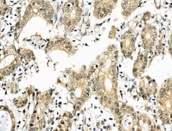 Invitrogen SIRT7 Polyclonal Antibody 100 &mu;L; Unconjugated:Anticuerpos