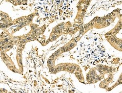 Invitrogen SIRT7 Polyclonal Antibody 100 &mu;L; Unconjugated:Anticuerpos
