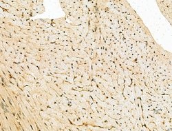 Invitrogen SIRT7 Polyclonal Antibody 100 &mu;L; Unconjugated:Anticuerpos