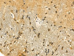 Invitrogen SIRT7 Polyclonal Antibody 100 &mu;L; Unconjugated:Anticuerpos