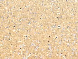 Invitrogen SLC16A8 Polyclonal Antibody 100 &mu;L; Unconjugated:Antibodies,