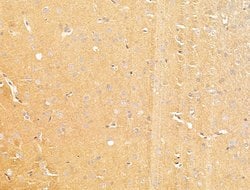 Invitrogen SLC16A8 Polyclonal Antibody 100 &mu;L; Unconjugated:Antibodies,