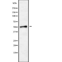 SLC18A1 Polyclonal Antibody:Antibodies, Polyclonal