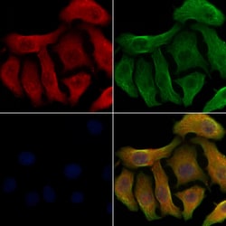 SLC22A6 Polyclonal Antibody:Antibodies, Polyclonal