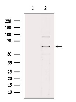 SLC22A6 Polyclonal Antibody:Antibodies, Polyclonal