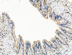 Invitrogen CTR1 Polyclonal Antibody 100 &mu;L; Unconjugated:Antibodies,