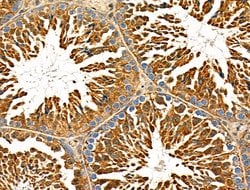 Invitrogen ZIP1 Polyclonal Antibody 100 &mu;L; Unconjugated:Antibodies,