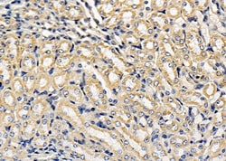 Invitrogen Nhe-1 Polyclonal Antibody 100 &mu;L; Unconjugated:Antibodies,