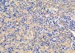 Invitrogen Nhe-1 Polyclonal Antibody 100 &mu;L; Unconjugated:Antibodies,
