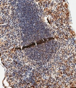 Invitrogen TLR2 Polyclonal Antibody 400 &mu;L | Buy Online | Invitrogen&trade; | Fisher Scientific